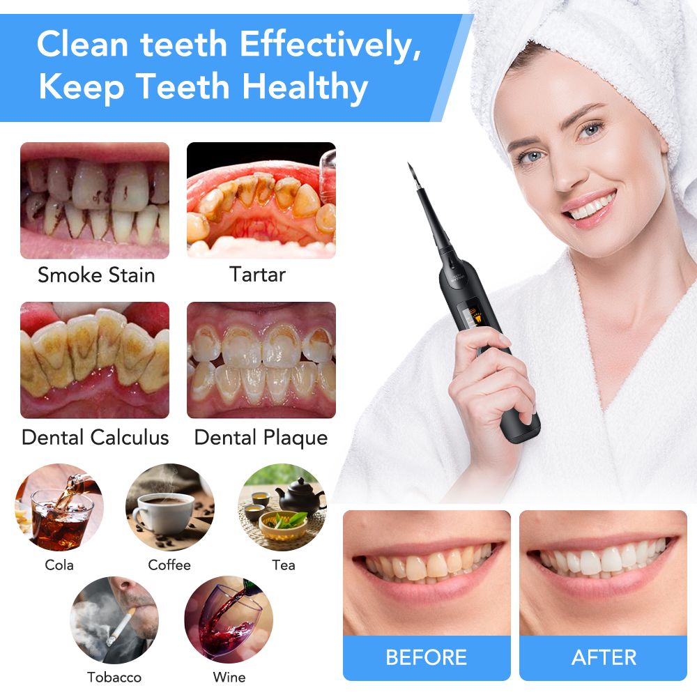 Electric Sonic Dental Calculus Remover Whitener Scaler LED Display